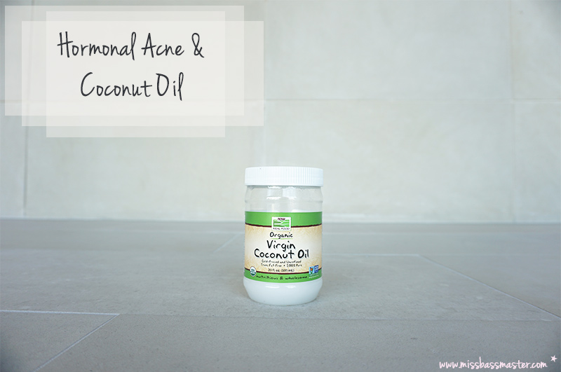 Coconut-Oil-and-Hormonal-Acne