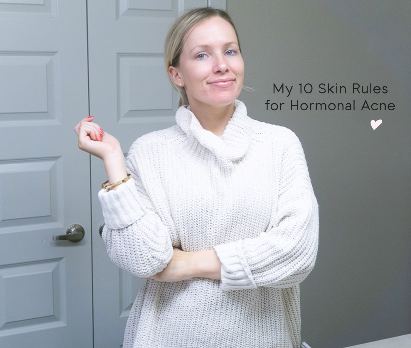 10-Skin-Rules-for-Hormonal-Acne